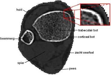 Hoofdstuk 7. Segmentatieprogramma s 88 van natuurlijke bronnen, krijgt men een idee van de impact van één zo n scan [52].