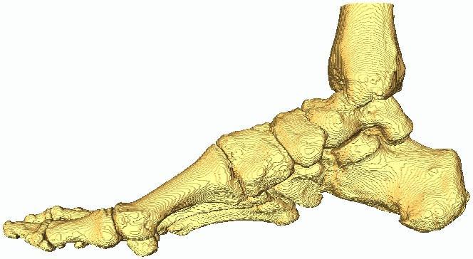 De onzuiverheden kunnen wel niet rechtstreeks in deze 3D weergave verwijderd worden, daarvoor moet teruggeschakeld worden naar de Segmentation Editor. Figuur 7.