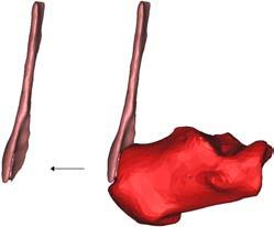 25: kraakbeenverbindingen in de voet Deze extrusiemethode kan ook toegepast worden om het contact tussen een pees en een bot te verzekeren.