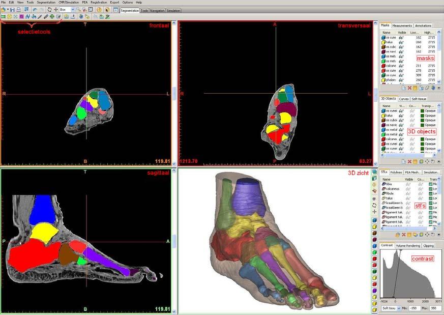 Bijlage C Beschrijving Functies Mimics In deze bijlage wordt uitgelegd hoe in Mimics scans geladen worden, gebieden afgebakend worden en