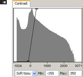 Bijlage C. Beschrijving Functies Mimics 175 worden via Contrast Control (Figuur C.5), dit is een soort van histogram dat zich rechtsonderaan het scherm bevindt.