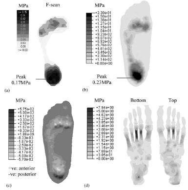 Hoofdstuk 5. Bestaande Biomechanische Modellen van de Voet 71 Figuur 5.