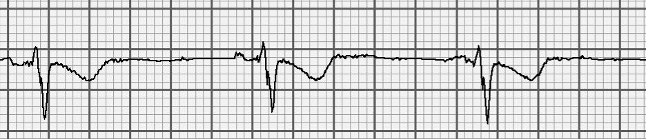 Wat is de frequenie? 1. 105 2.