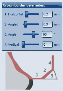 TOEPASSING Randparameters in CAD-software Er moet bij Zolid op worden gelet dat de randdikten voldoende zijn. Geadviseerde waarden zijn: _ 1. Randdikte (Horizontal): 0,2 mm _ 2.