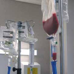 Hogedosis-chemotherapie met autologe stamceltransplantatie Bij sommige patiënten wordt beslist om chemotherapie in hoge dosis te geven.