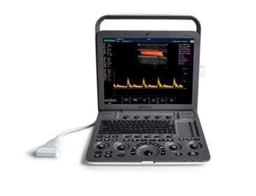 15 LCD display op beweegbare arm Compound Imaging en Speckle Reduction Imaging Pulse Wave Colour Doppler Trapezoid imaging Scandiepte to 26 cm 500 GB HDD opslagcapaciteit Inclusief C322 microconvex,