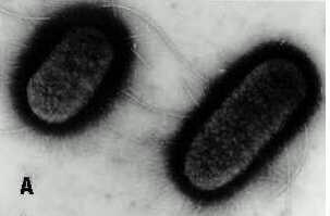 LITERATUURSTUDIE 1. AGEMENE INLEIDING OVER ESCHERICHIA COLI 1.1. Classificatie In 1885 beschreef Theodore Escherich voor het eerst het organisme Escherichia coli (E. coli) (Donnenberg, 2002). E. coli is een gram-negatieve staaf, behorend tot de familie van de Enterobacteriaceae.