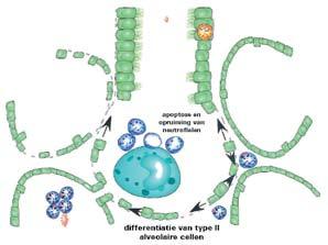 neutrofielinflux apoptose en opruiming van neutrofielen directe schade aan type I- epitheelcellen A differentiatie van type II alveolaire cellen trombi tissue factor /VII B trombine fibrinebeslag