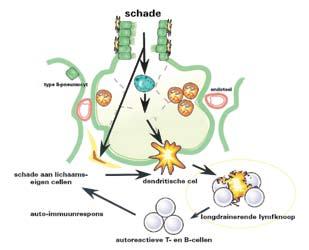 K l i n i s c h e i m m u n o l o g i e type II-pneumocyt schade aan lichaamseigen cellen schade TNF-α dendritische cel endotheel van de ziekte ook georganiseerde aggregaten van T- en B-lymfocyten