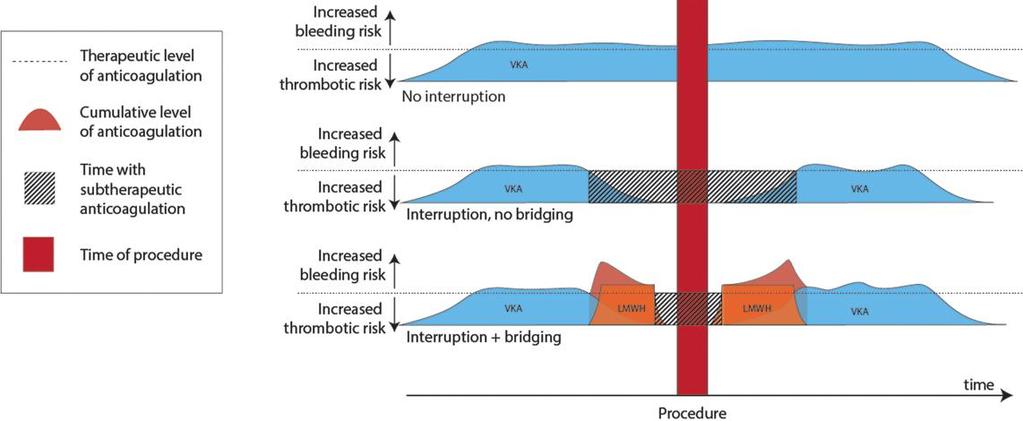 Figuur 1.1 Overbrugging met een LMWH tijdens de onderbreking van een VKA in vergelijking met het doorgebruiken of enkel onderbreken van de VKA. Figuur overgenomen uit Vanassche et. al. 20