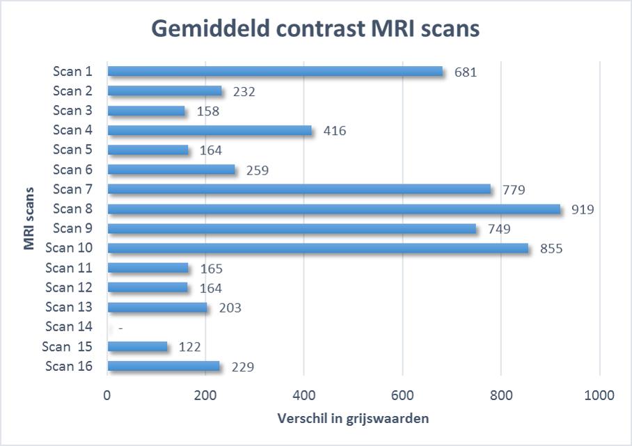 Figuur 20: De verschillen in grijswaarden bij de 3T (1t/m5), 7T (6 t/m 10) en 3T in vivo (11 t/m 16) MRI scans. 6.1.3 Artefacten De mate waarin de artefacten voorkwamen op 3T en 7T scans waren verschillend.