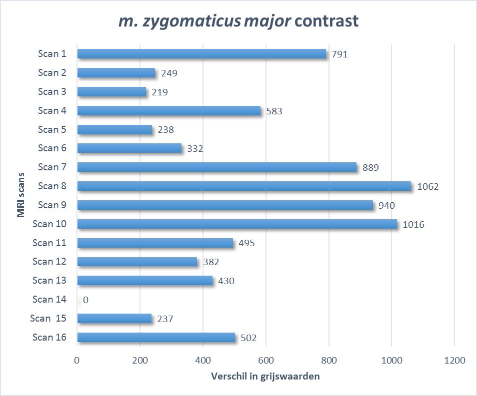 Figuur 28: De verschillen in grijswaarden van