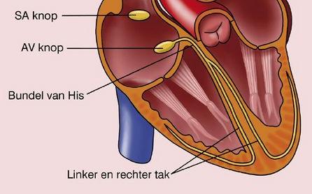 6 QRS morfologie pathologische Q golven? LVH / RVH? microvoltages?