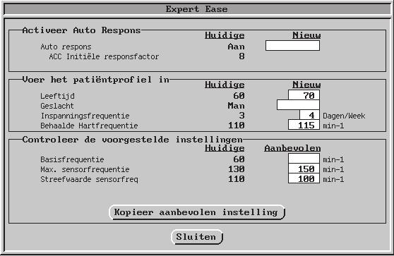 6-40 THERAPIE SENSOR SUBMENU AUTOMATISCHE RESPONSFACTOR Figuur 6-27. Het scherm Expert Ease.