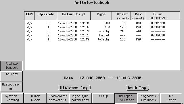 7-18 DIAGNOSTISCHE FUNCTIES EN CONTROLES THERAPIEOVERZICHT Wanneer het scherm Aritmielogboek (Figuur 7-3) wordt geopend, worden de aritmiegegevens weergegeven die tijdens het initiële uitlezen werden