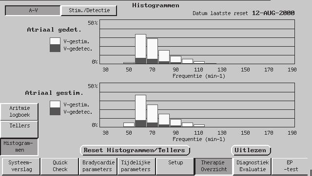 DIAGNOSTISCHE FUNCTIES EN CONTROLES THERAPIEOVERZICHT 7-23 Figuur 7-6. Het scherm Histogrammen.