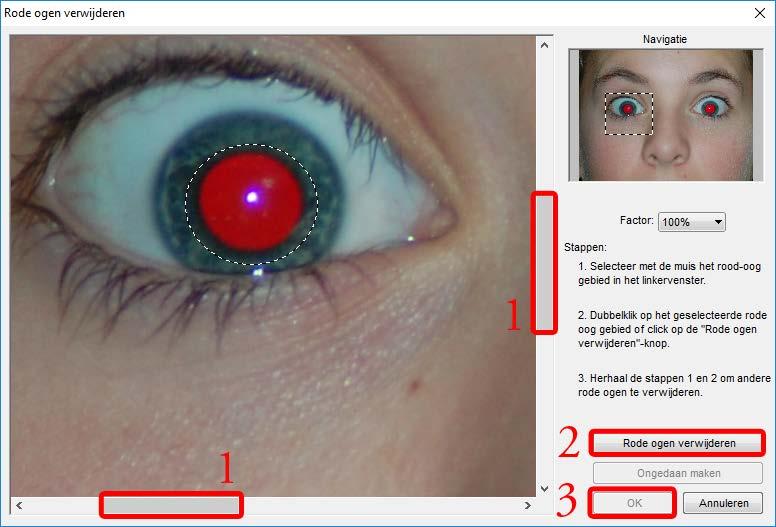 i. Rode ogen verwijderen (Menubalk: Bewerken) Met deze functie kunt u rode ogen uit een foto verwijderen die soms bij flitsen ontstaan, in werkelijkheid is dit weerkaatsing van licht op het netvlies