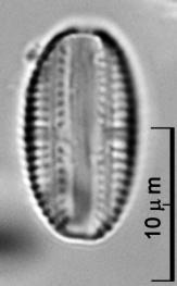 Fig. 2 (links): Vlottende waterranonkel Ranunculus fluitans. Foto: K. van de Weyer. Fig. 3 (rechts): Kiezelalgen Amphora pediculus en Navicula tripunctata. Foto: M. Werum 3.