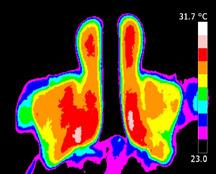 Voorbereiding opnametechniek. Stralingsleer in praktijksituaties. Beoordelen van de ruimte voor het thermografisch onderzoek. Patiënt voorbereiding.