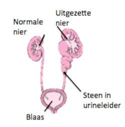 Symptomen van nierstenen Zoals eerder gezegd ontstaan de stenen in de nier. Veel mensen hebben nierstenen, waarvan ze totaal niets voelen.