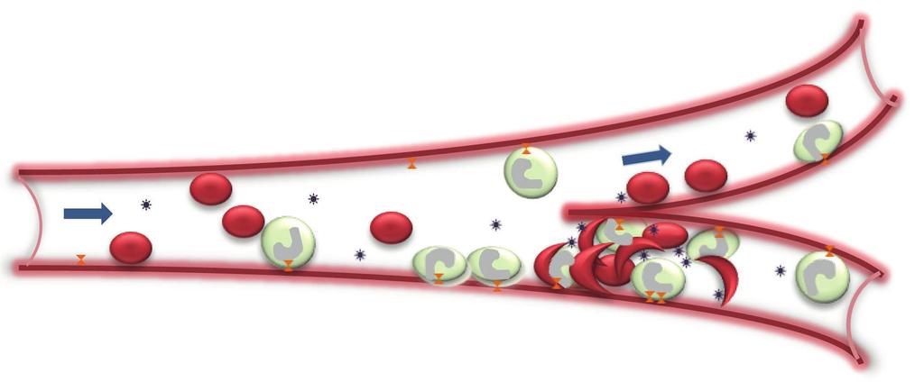 NEDERLANDS TIJDSCHRIFT VOOR HEMATOLOGIE 7 Figuur 1. Adhesie van leukocyten, erytrocyten en trombocyten leidend tot vaso-occlusie.