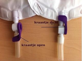 Afbeelding 4: kraantje open en dicht Als u moeilijk bij het toilet kunt komen, kunt u de urine laten weglopen in een urinaal of in de nachtzak. Iemand anders leegt dit voor u in het toilet.