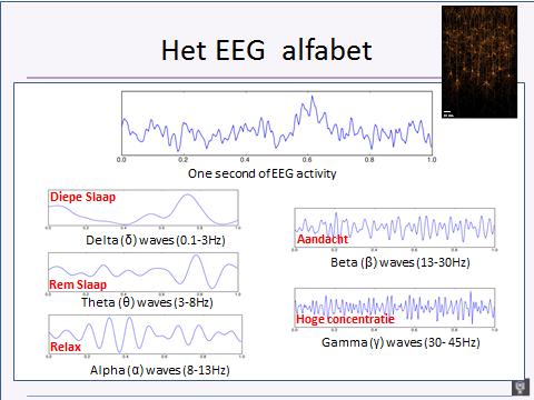 OPDRACHT 1 Een EEG-signaal wordt weergegeven als een aantal grafieken, waarin de gemeten (elektrische) spanning op de verticale as staat en de tijd op de horizontale as.