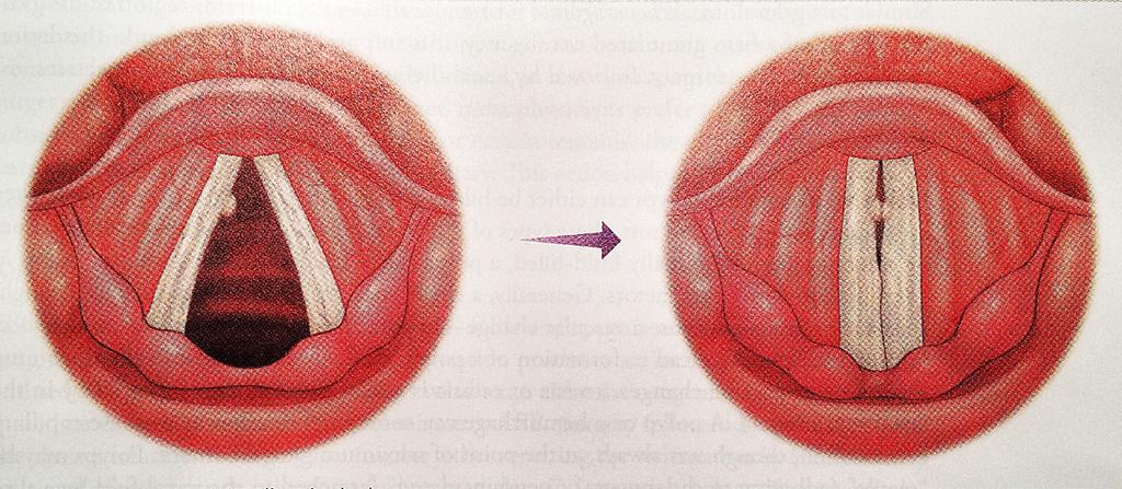 20 21 zingen en in vibratoproblemen. Allen werden in diverse reacties genoemd. Abitbol/ Benninger (2006) schrijven dat de larynx neurologisch grotendeels aangestuurd wordt door de nervus vagus.