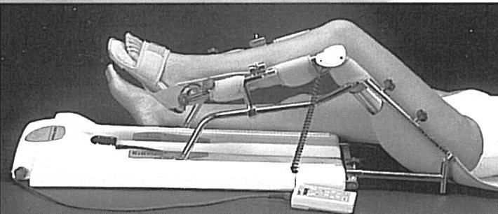 Multidisciplinaire revalidatie Kinesitherapie Na het plaatsen van een knieprothese is het van groot belang om tijdig te starten met de revalidatie.