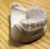 Heeft u nog eigen tanden en kiezen, dan zal de tandarts een afdruk maken van uw gebit. Hiermee worden beschermkapjes en fluoridekapjes gemaakt. Beschermkapjes draagt u tijdens de bestraling.