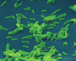 spp. Infectie van de onderste luchtwegen 1 25 % 30 180 minuten Escherichia coli Urineweginfectie onbekend 6 90 minuten Gisten inclusief