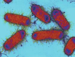 Infectie van de onderste luchtwegen, urineweginfectie, sepsis 23 81 % 1 uur Rotavirus Virale gastro-enteritis, vooral bij kinderen 20 79