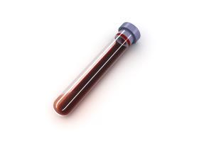 Bloedafname Er wordt bij elke uitgebreide meting een kleine hoeveelheid bloed (15 ml, 1 buisje) bij uw kind afgenomen door een gespecialiseerd verpleegkundige.