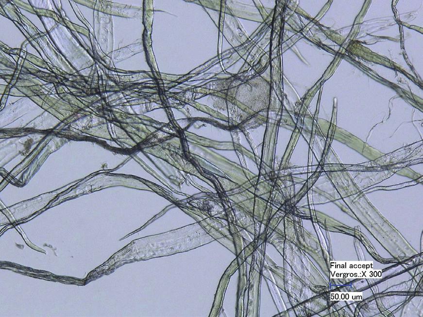 beperkt aantal vezels aanwezig, die langer waren dan 1,5 mm. Deze kunnen afkomstig zijn uit textiel of andere bewerkte celluloseproducten zoals viscose.