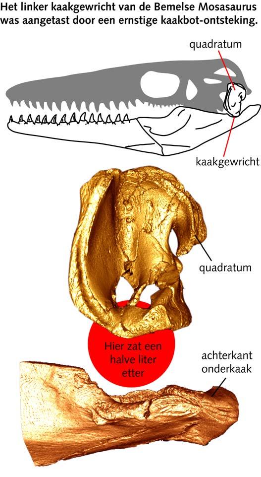 Mosasaurus overleefde gruwelijke kaakontsteking Prehistorisch zeereptiel zwom rond met halve liter etter in kaakbot Onderzoekers in Maastricht hebben de versteende kaak van een 66 miljoen jaar oud