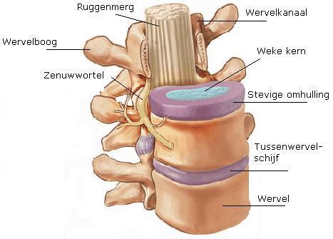 Ze bestaan uit een stevig omhulsel (annulus fibrosus) en een weke, buigzame kern, de nucleus pulposis. Dit kunt u zien op de afbeelding hiernaast.