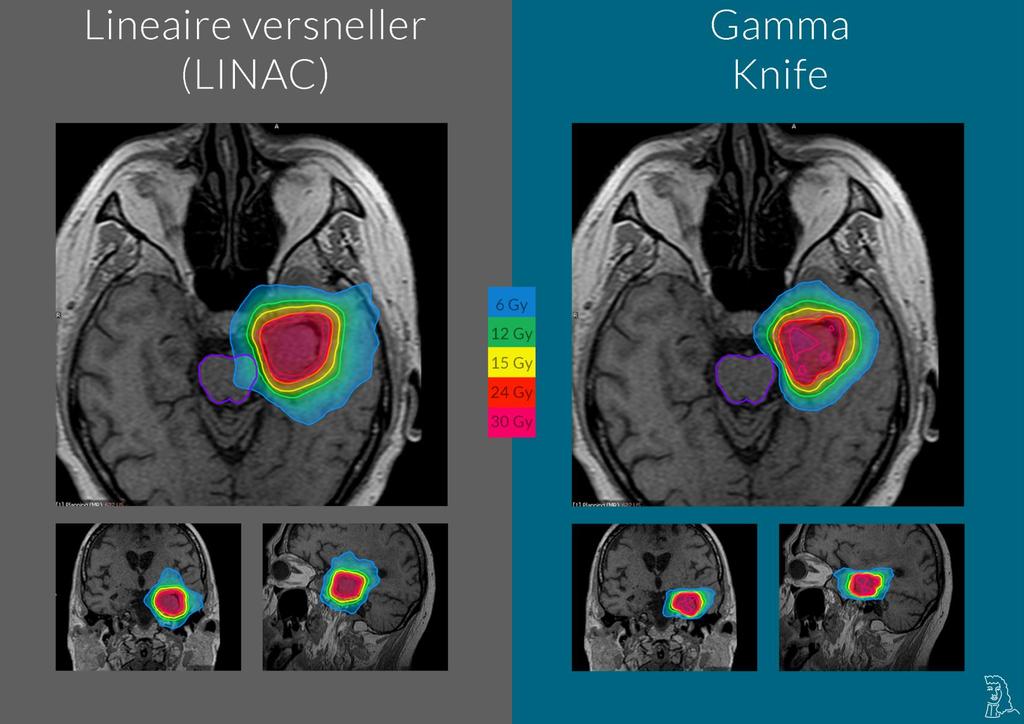 LINAC BASED VERSUS