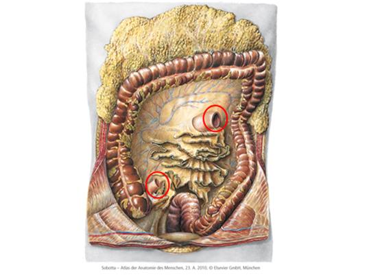 colon transversum intraperitoneaal duodenum secundair retroperitoneaal jejunum intraperitoneaal pancreas secundair retroperitoneaal 37 of 52 In deze afbeelding zijn tussen de aangeduide doorgesneden