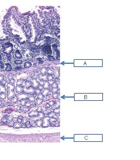 Wandcellen (pariëtale cellen) in de maagwand worden gekenmerkt door een uitgebreid netwerk van [mitochondriën] wat nodig is voor de [secretie van HCl] 43 of 52 U ziet hier een histologisch preparaat