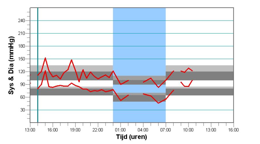 WAAROM 24-UURS BLOEDDRUKMETING? In overleg met uw arts wordt er bij u een 24-uurs bloeddrukmeting uitgevoerd.