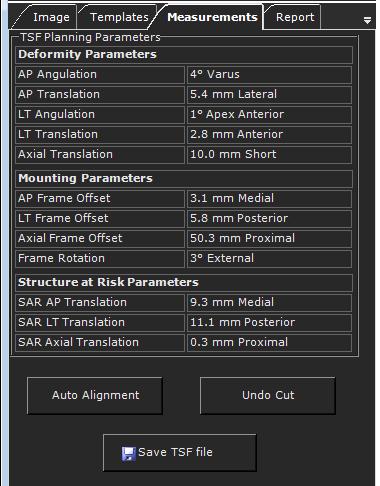 Het gebied met de TSF-planparameters (TSF Planning Parameters) toont alle berekende parameters voor hulpmiddel Taylor