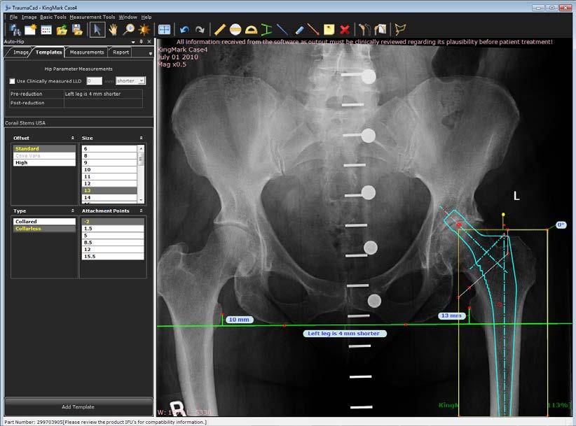 De toepassing detecteert automatisch de anatomische regio's in de afbeelding.