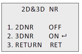 NR Ruisonderdrukking (NR) reduceert ruis, voornamelijk in geval van weinig licht om de beeldprestaties te verbeteren.