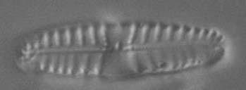 Resultaten Foto 1 Reimeria sinuata een bijzonderde diatomee van oude rivierafzettingen.