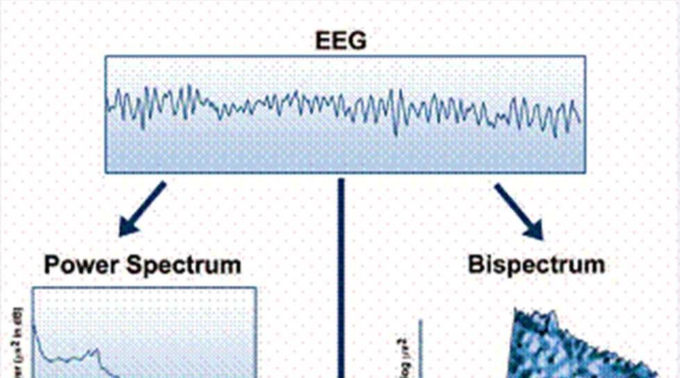 BIS Ontwikkeld op basis EEG