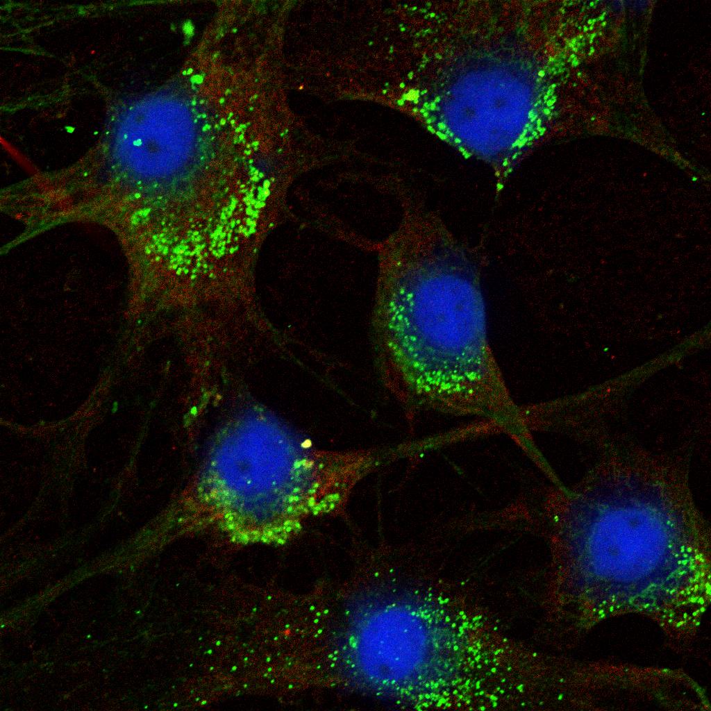 S A M E N VAT T I N G Kijk eens naar de de volgende figuren: Het linkerplaatje is met een microscoop gemaakt en toont een menselijke cel.