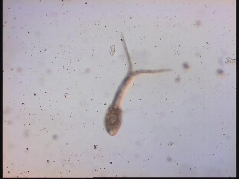 Figuur 27: Een cecarie van Trichobilharzia occulata onder de microscoop. Dit is een watermonster uit.