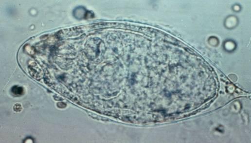 Het goede antwoord is S. intercalatum S.