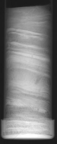 Figuur 2.5: Radiografie van Reineck cores (breedte is 5 cm).