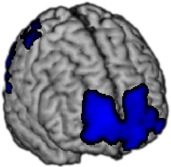 Volman ea, 11, Current Biology a. Neurale stimulatie: TMS over : a.